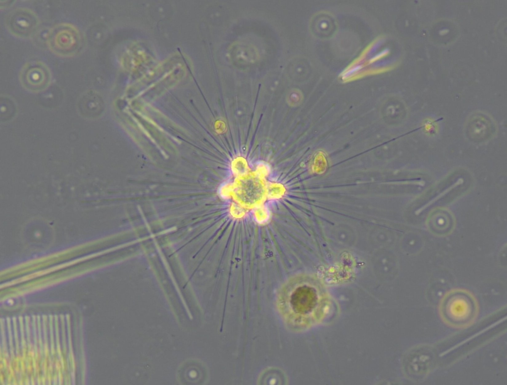 Mikroskopische Aufnahme eines Sonnentierchens - Heliozoa